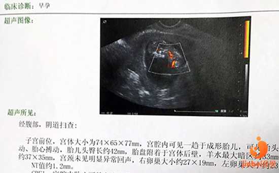 试管代生中心，【广州卵巢早衰供卵电话】同时希望想要宝宝的姐妹们接好孕，